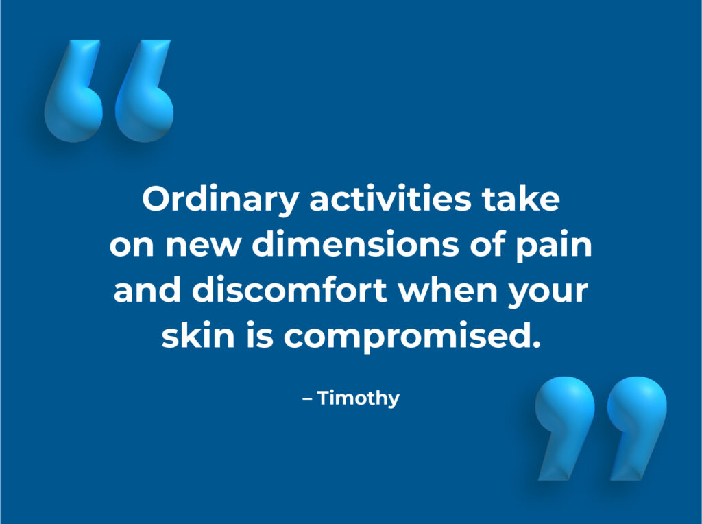 Ordinary activities take on new dimensions of pain and discomfort when your skin is compromised - Timothy Ordinary activities take on new dimensions of pain and discomfort when your skin is compromised - Timothy