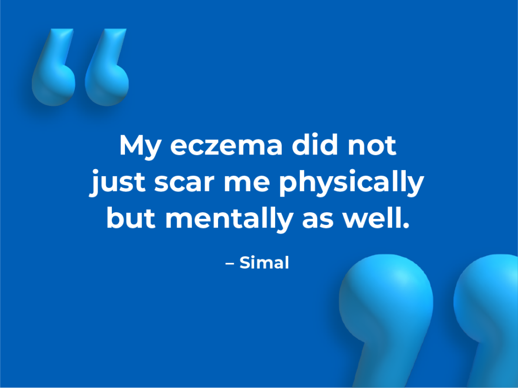 Share Your Story – Simal’s Story Share Your Story – Simal’s Story